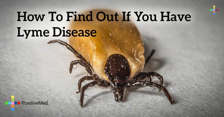 How to Find Out if You Have Lyme Disease How to Find Out if You Have Lyme Disease