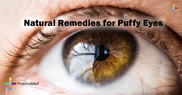 Natural Remedies for Puffy Eyes Natural Remedies for Puffy Eyes