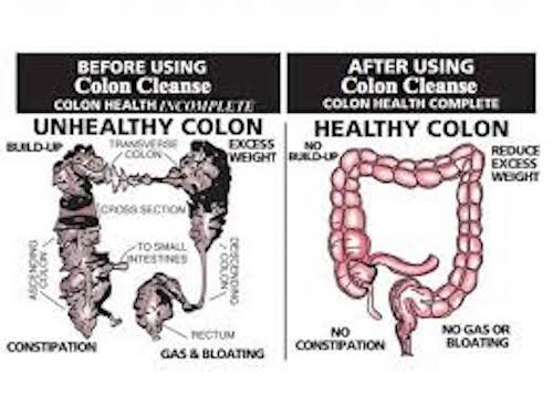 Natural Foods to Cleanse the Colon