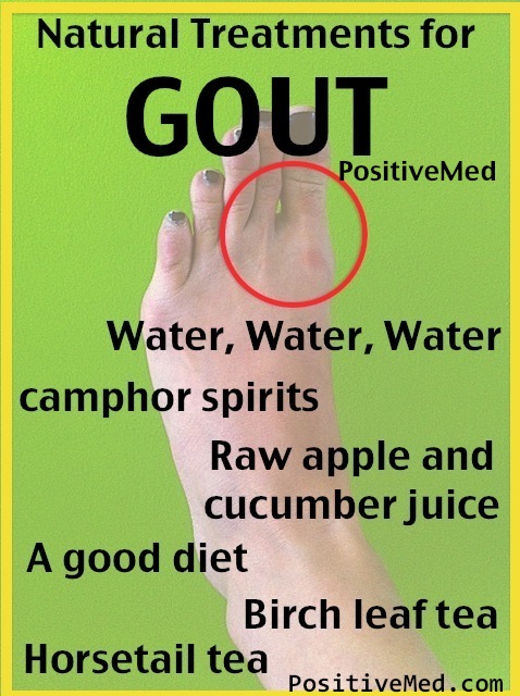 Gout: Natural Treatments