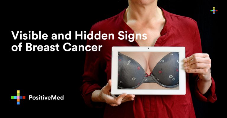 Visible and Hidden Signs of Breast Cancer Visible and Hidden Signs of Breast Cancer