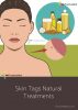 Skin Tags Natural Treatments