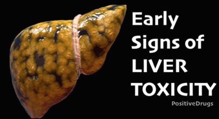 5 Common Causes of Liver Toxicity
