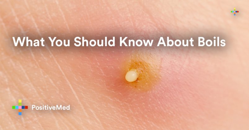 What You Should Know About Boils What You Should Know About Boils