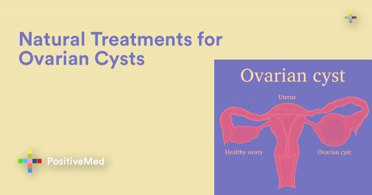 Natural Treatments for Ovarian Cysts Natural Treatments for Ovarian Cysts