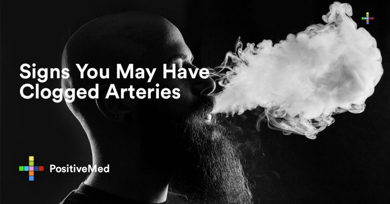 Signs You May Have Clogged Arteries Signs You May Have Clogged Arteries