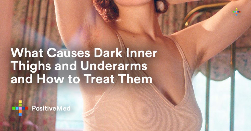 What Causes Dark Inner Thighs and Underarms and How to Treat Them