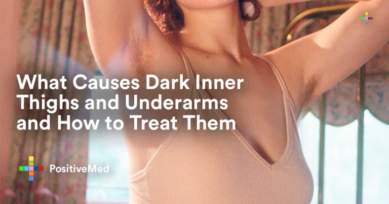 What Causes Dark Inner Thighs and Underarms and How to Treat Them What Causes Dark Inner Thighs and Underarms and How to Treat Them