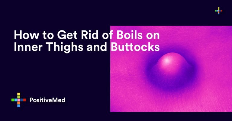 How to Get Rid of Boils on Inner Thighs and Buttocks