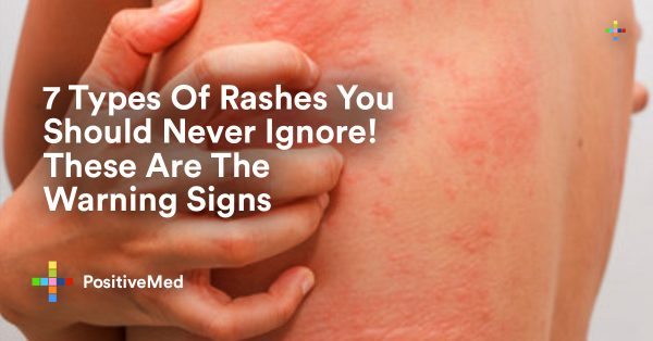 7 Types Of Rashes You Should Never Ignore! These Are The Warning Signs ...