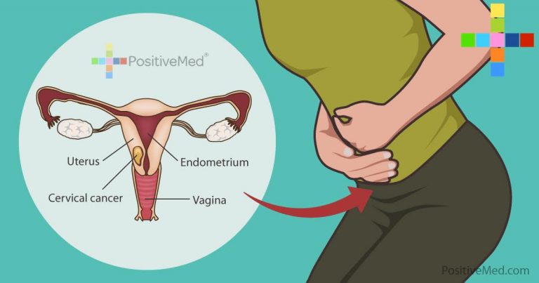 7 Warning Signs of Cervical Cancer that Women Often Ignore! 7 Warning Signs of Cervical Cancer that Women Often Ignore!