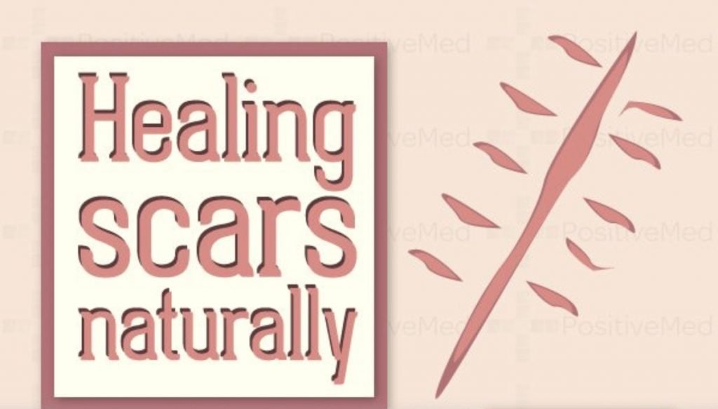 Healing Scars Naturally: Which Remedies Work Best?