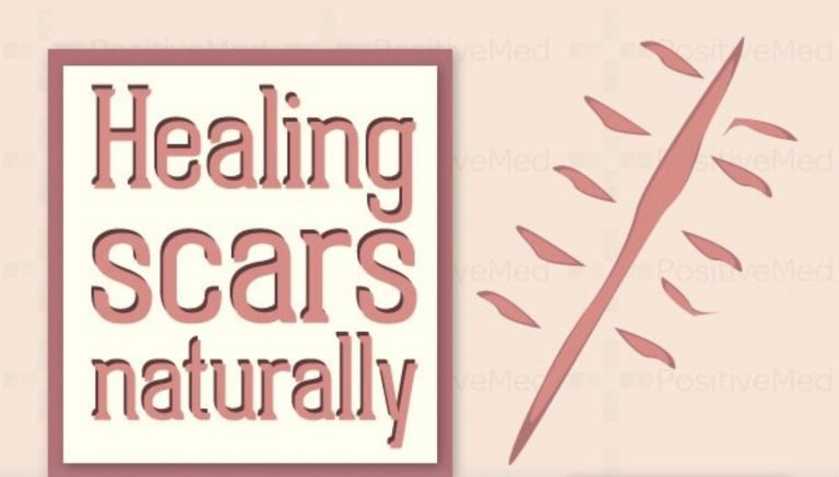 5 Facts You Need Know About Scars and How to Get Rid of Them 5 Facts You Need Know About Scars and How to Get Rid of Them