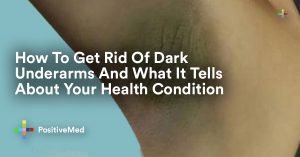How To Get Rid Of Dark Underarms And What It Tells About Your Health Condition