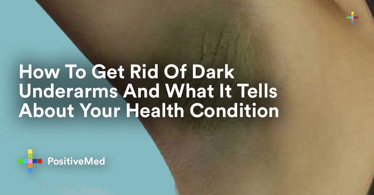 How To Get Rid Of Dark Underarms And What It Tells About Your Health