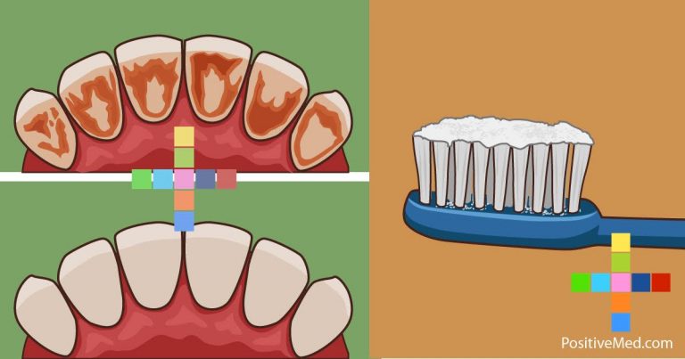 How to Remove Tartar, Clean Plaque and Destroy Bacteria With Only One Ingredient! How to Remove Tartar, Clean Plaque and Destroy Bacteria With Only One Ingredient!