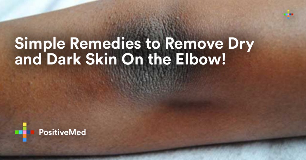 Simple Remedies to Remove Dry and Dark Skin On the Elbow!