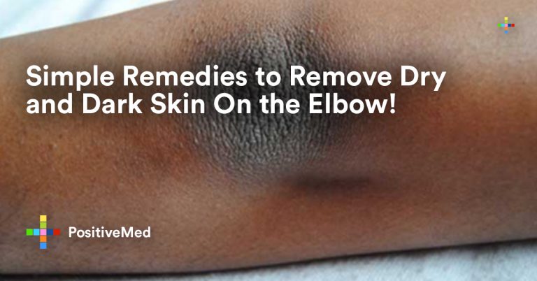 Simple Remedies to Remove Dry and Dark Skin On the Elbow! Simple Remedies to Remove Dry and Dark Skin On the Elbow!