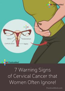 7 Warning Signs of Cervical Cancer that Women Often Ignore