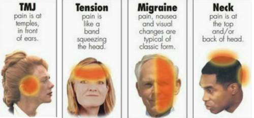 11 Migraine Triggers That Will Surprise You