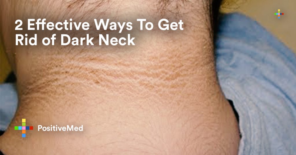 2 Effective Ways To Get Rid of Dark Neck.
