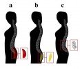Spine Curves