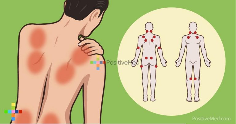 Study Linked THIS Common Vitamin Deficiency To Your Joint And Back Pain Study Linked THIS Common Vitamin Deficiency To Your Joint And Back Pain