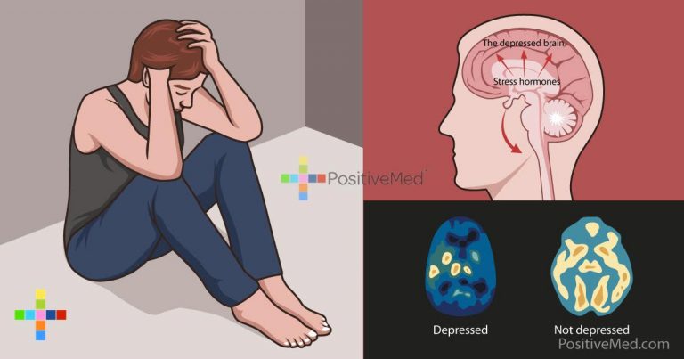 This Is What Happens To Your Brain And Memory When You’re Depressed
