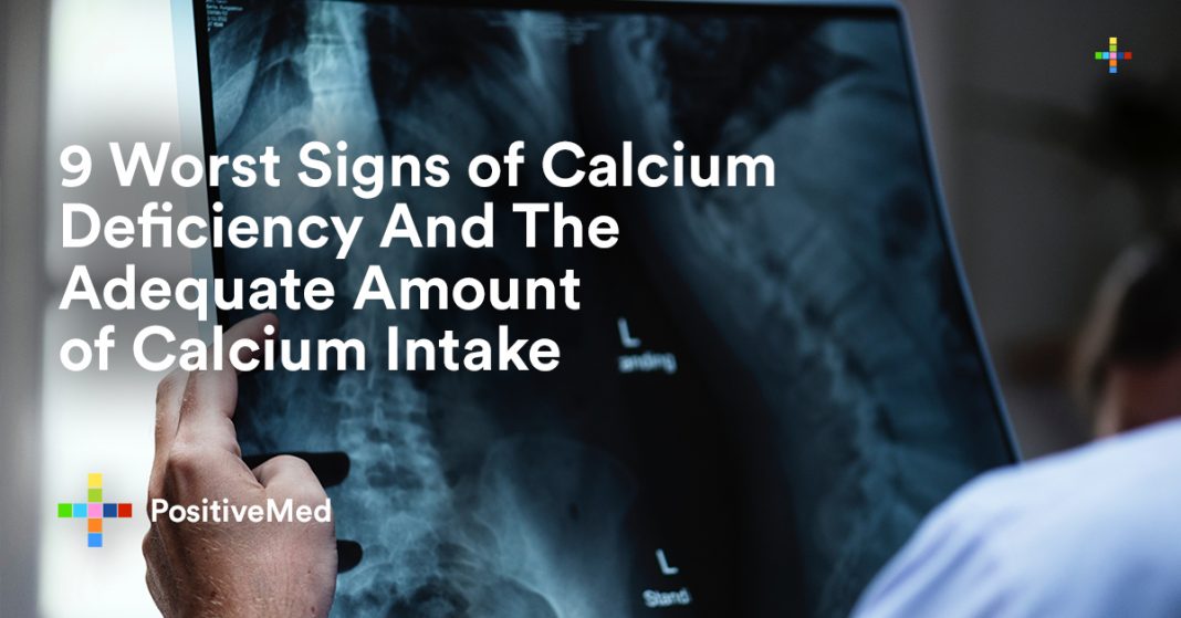 9 Worst Signs of Calcium Deficiency And The Adequate Amount of Calcium