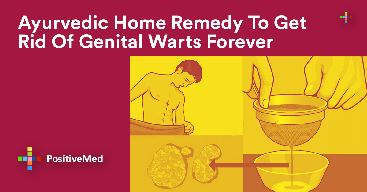 how quickly can you get rid of genital warts