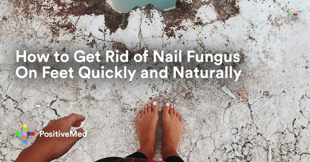 How to Get Rid of NAIL FUNGUS On Feet Quickly and Naturally