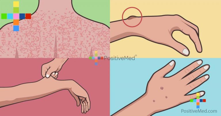 Your Skin Problems Could Indicate Internal Cancer; Here’s What You Need To Know