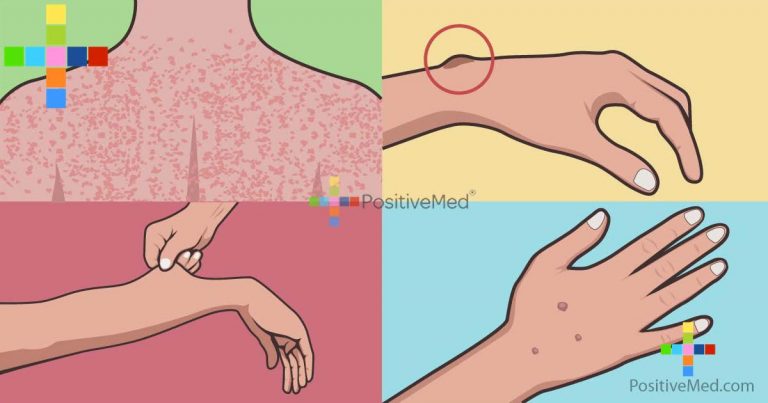Your Skin Problems Could Indicate Internal Cancer; Here’s What You Need To Know Your Skin Problems Could Indicate Internal Cancer; Here’s What You Need To Know