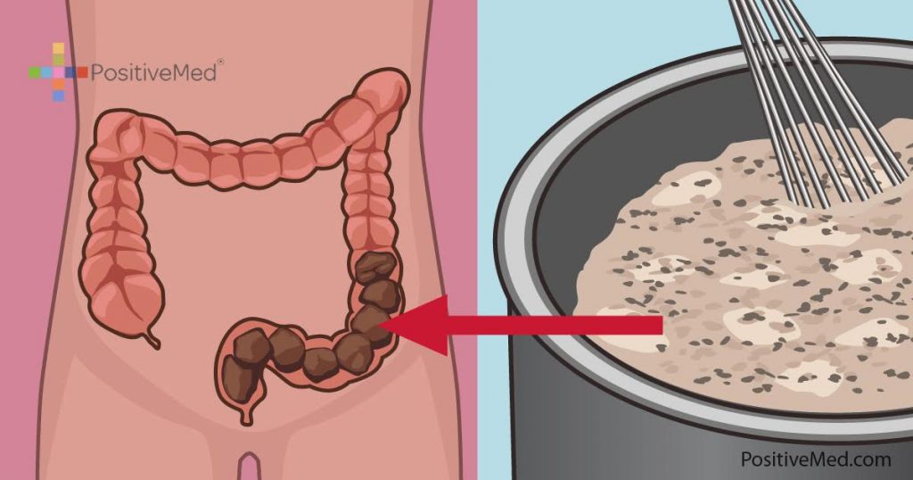 Empty Your Colon of TOXIC Waste With This 4-Ingredient Apple-Honey Mixture