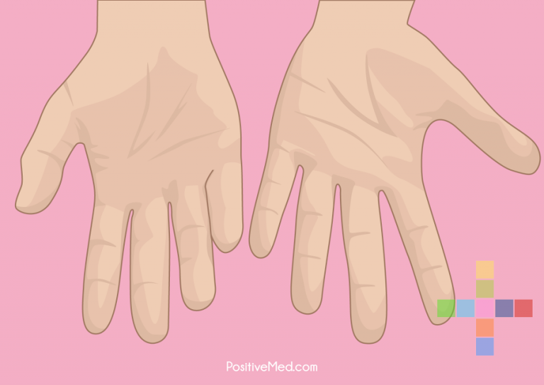 Warning Signs of Poor Blood Circulation That Lead to Grave Health Problems Warning Signs of Poor Blood Circulation That Lead to Grave Health Problems