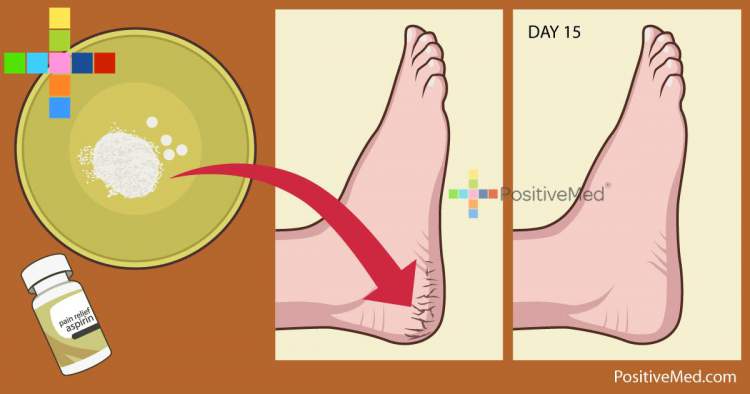 Simple Method to Solve Your Foot Problems