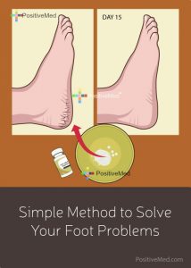 Simple Method to Solve Your Foot Problems