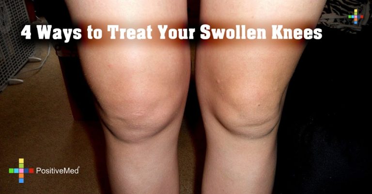 4 Ways to Treat Your Swollen Knees 4 Ways to Treat Your Swollen Knees