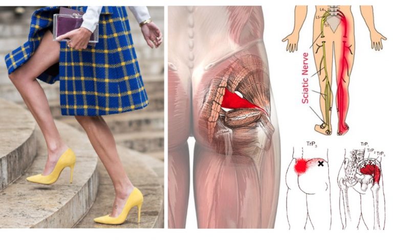 How You Aggravate Sciatica Without Realizing It How You Aggravate Sciatica Without Realizing It