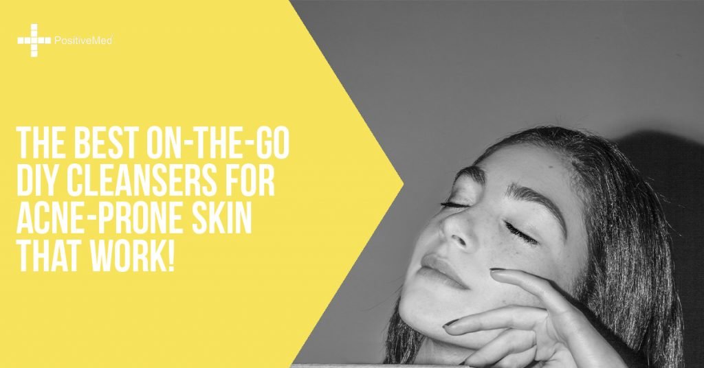 The Best On-the-Go DIY Cleansers for Acne-Prone Skin that Work!