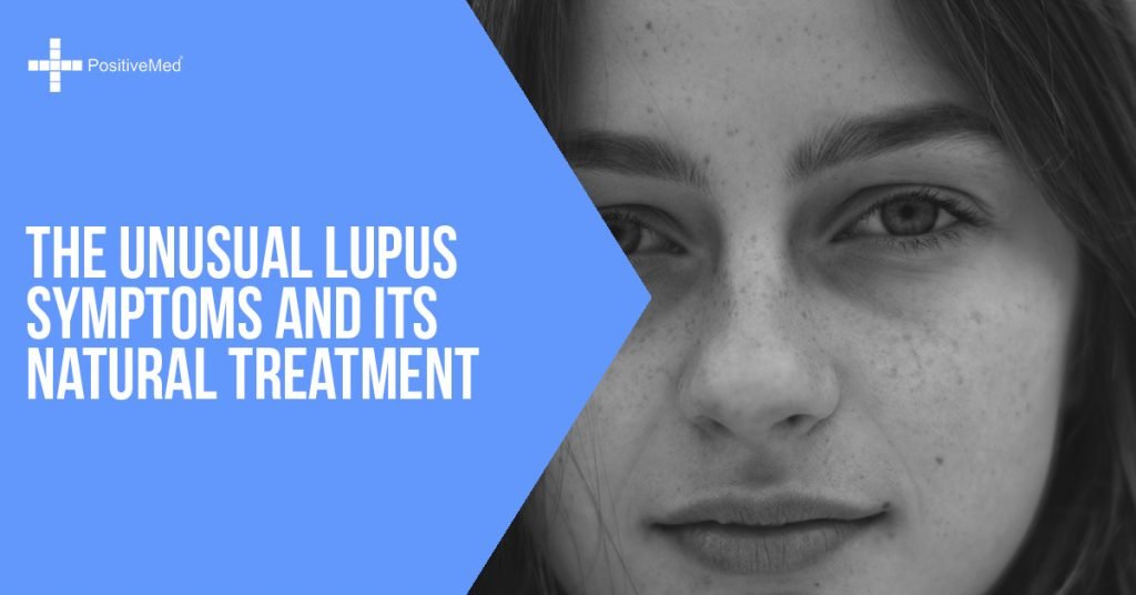 The Unusual Lupus Symptoms and Its Natural Treatment