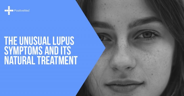The Unusual Lupus Symptoms and Its Natural Treatment The Unusual Lupus Symptoms and Its Natural Treatment
