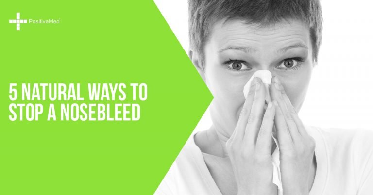 5 Natural Ways to Stop a Nosebleed 5 Natural Ways to Stop a Nosebleed