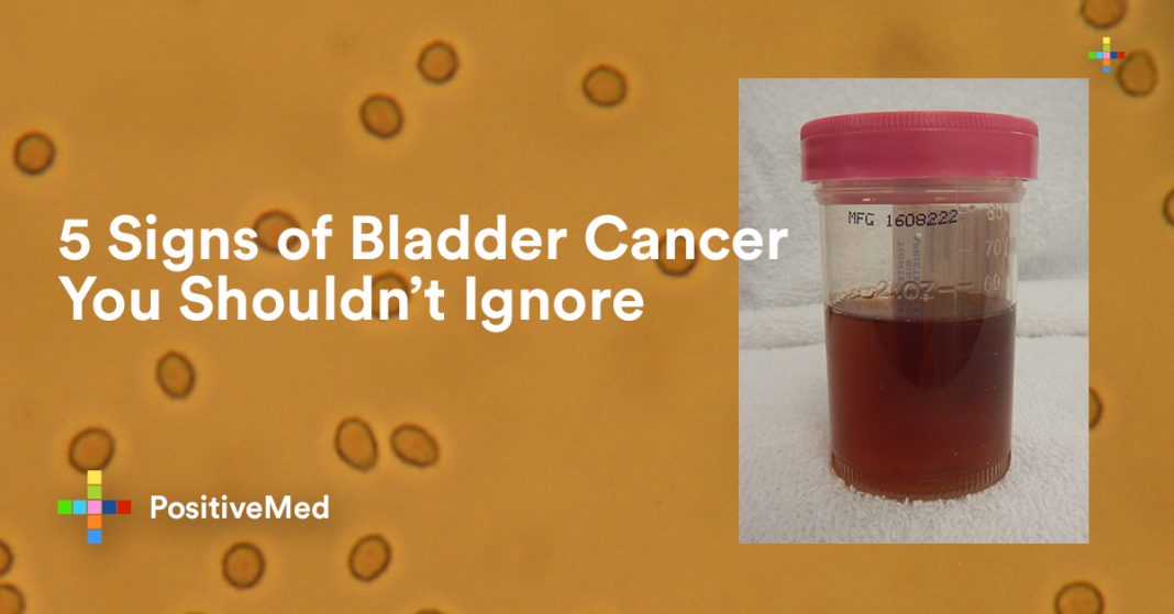 5 Signs of Bladder Cancer You Shouldn't Ignore PositiveMed