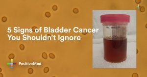 5 Signs of Bladder Cancer You Shouldn't Ignore