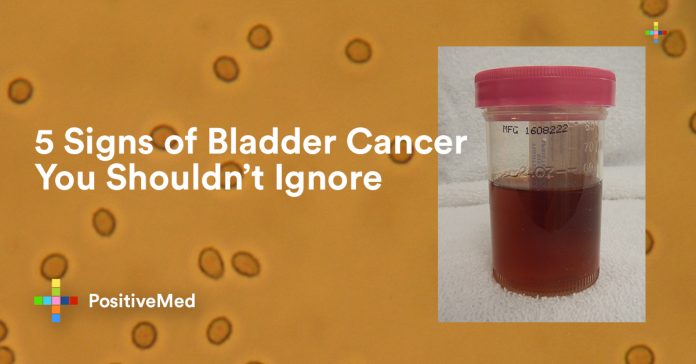 5 Signs of Bladder Cancer You Shouldn't Ignore