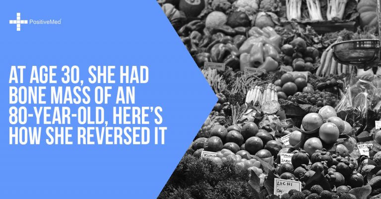 At Age 30, She Had Bone Mass of an 80-Year-Old, Here’s How She Reversed It At Age 30, She Had Bone Mass of an 80-Year-Old, Here’s How She Reversed It