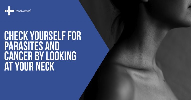 Check Yourself for Parasites and Cancer by Looking at Your Neck Check Yourself for Parasites and Cancer by Looking at Your Neck