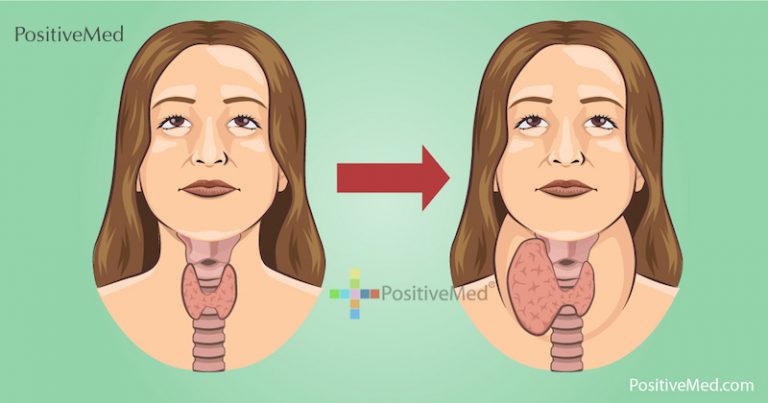 These 2 Iodine Rich Foods Destroy Your Thyroid from the Inside These 2 Iodine Rich Foods Destroy Your Thyroid from the Inside