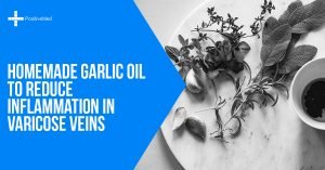 Homemade Garlic Oil to Reduce Inflammation in Varicose Veins